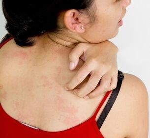 granulomy na těle - příznaky přítomnosti parazitů