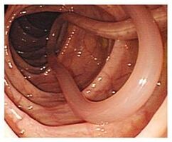parazitů v lidském těle