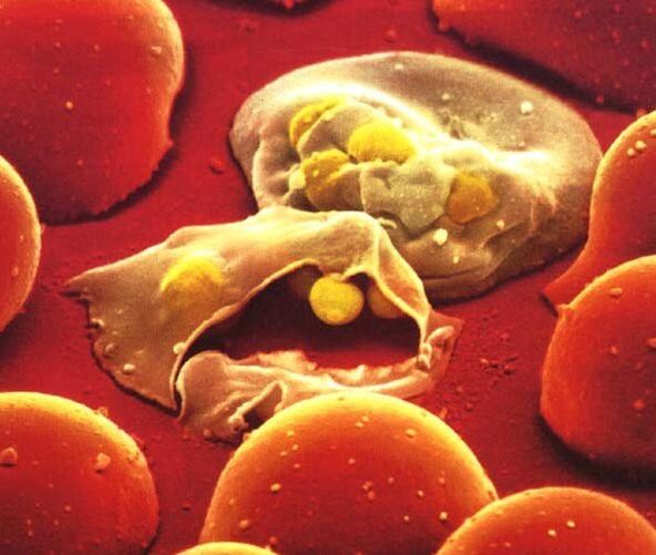 nejjednodušší parazit malárie plasmodium