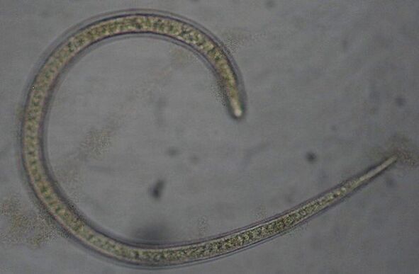 Trichinella je protostomický kulatý parazitický červ